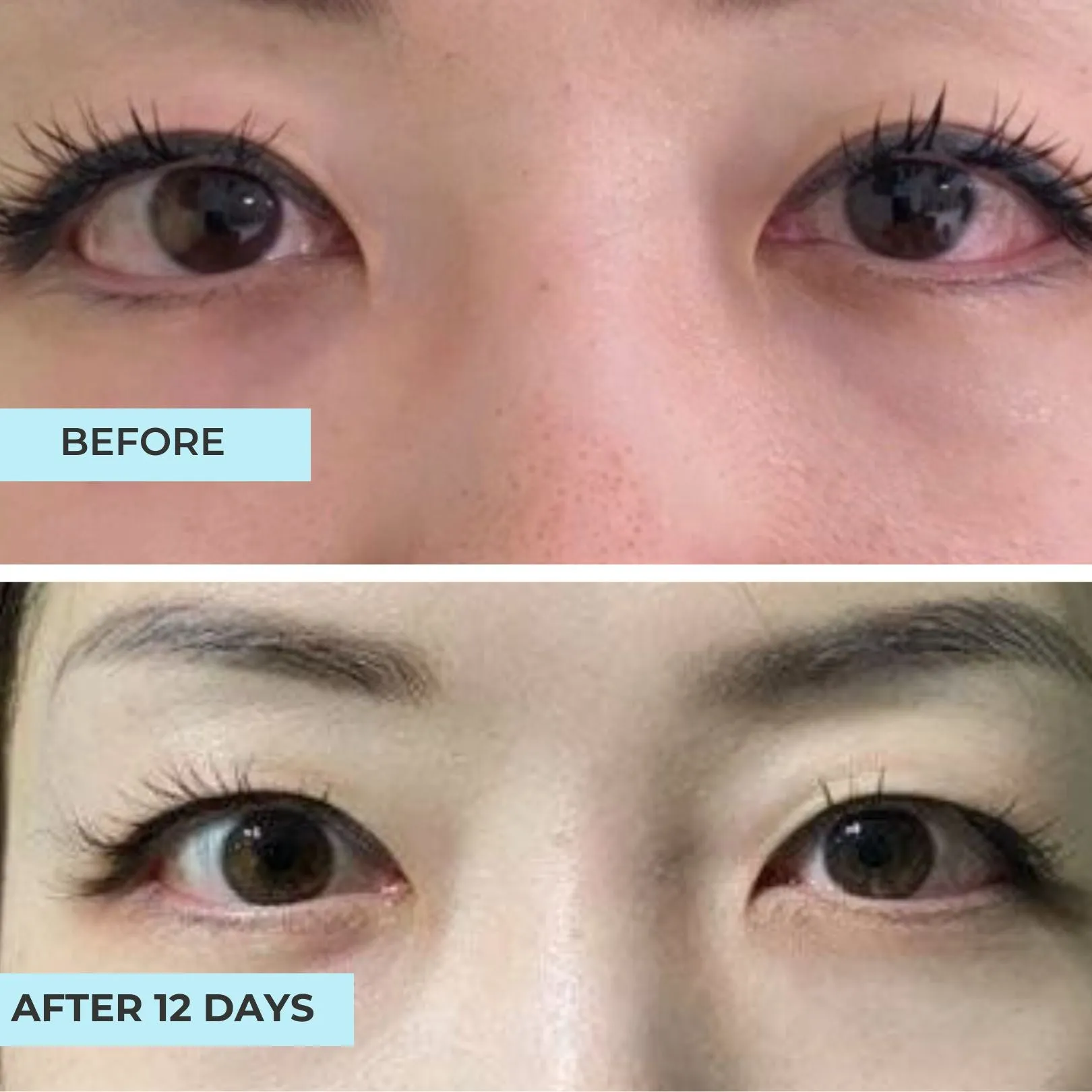 Advanced Peptide Repair Eye Concentrate