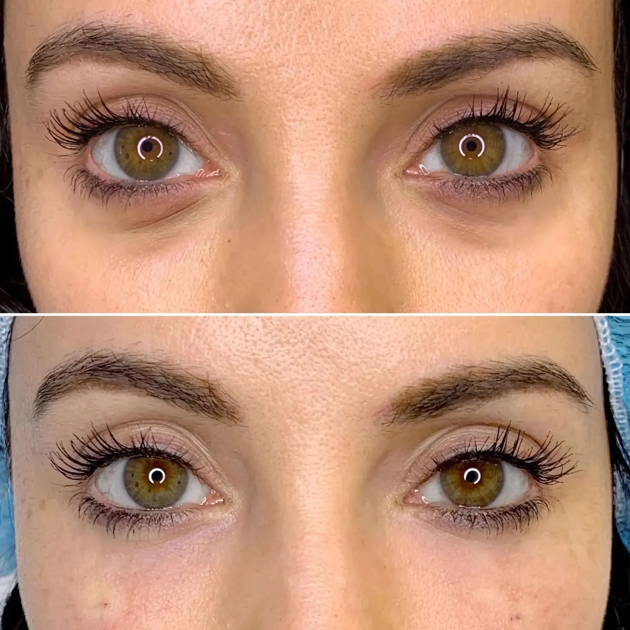 EyeFix: Filler